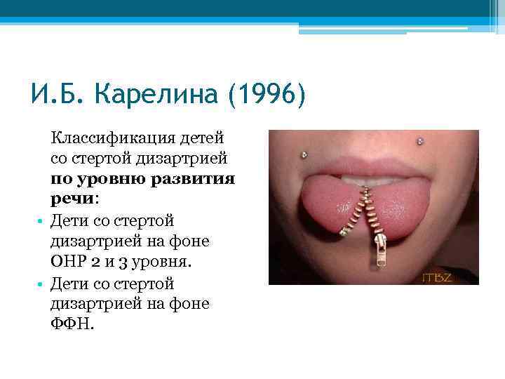 И. Б. Карелина (1996) Классификация детей со стертой дизартрией по уровню развития речи: •