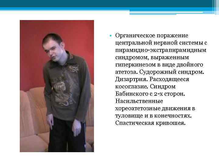  • Органическое поражение центральной нервной системы с пирамидно-экстрапирамидным синдромом, выраженным гиперкинезом в виде