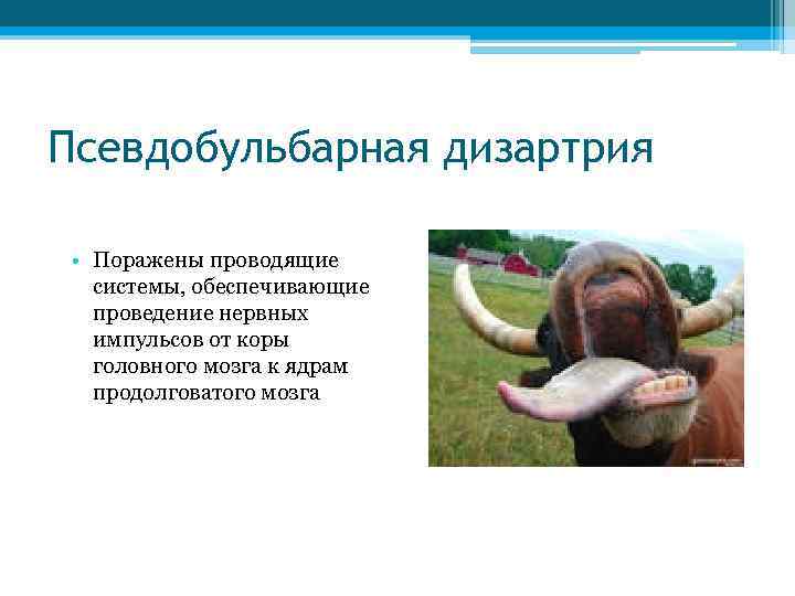 Псевдобульбарная дизартрия • Поражены проводящие системы, обеспечивающие проведение нервных импульсов от коры головного мозга