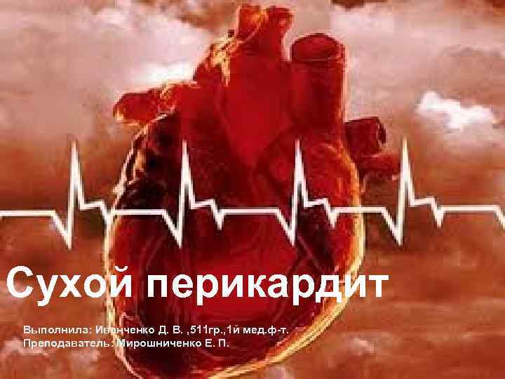 Сухой перикардит Выполнила: Иванченко Д. В. , 511 гр. , 1 й мед. ф-т.