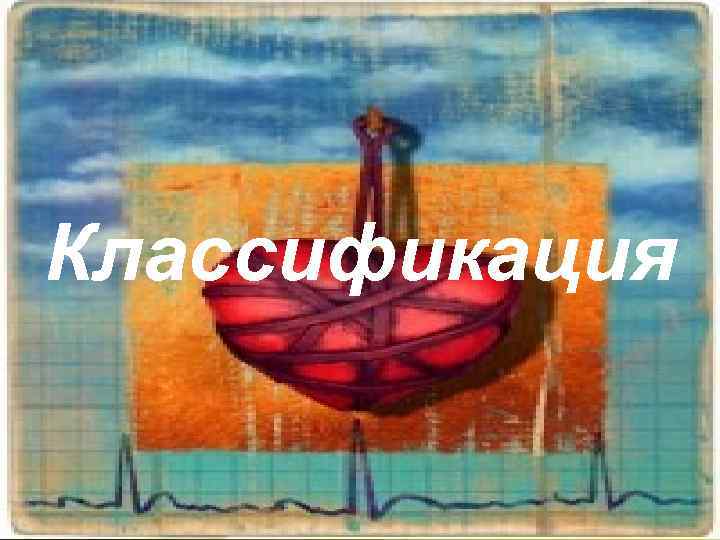 Классификация 