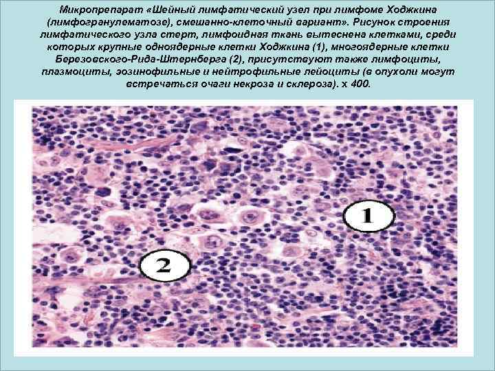 Селезенка лимфоциты