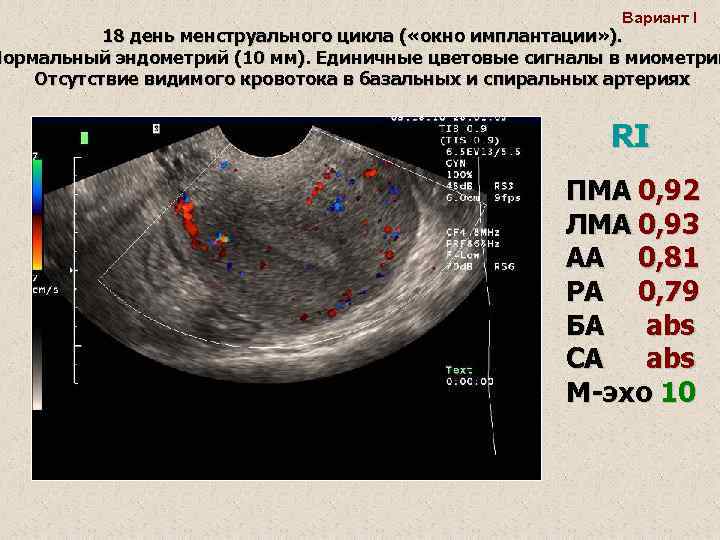 Размеры матки в менопаузе. Норма эндометрия на УЗИ. Эндометрий 8мм это норма. Эндометрий на 2 день цикла. Эндометрий 1 фаза менструационного цикла.