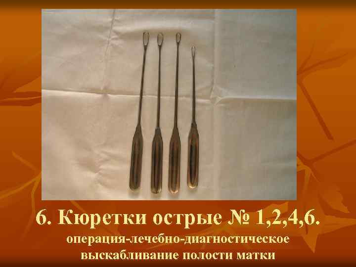 6. Кюретки острые № 1, 2, 4, 6. операция-лечебно-диагностическое выскабливание полости матки 