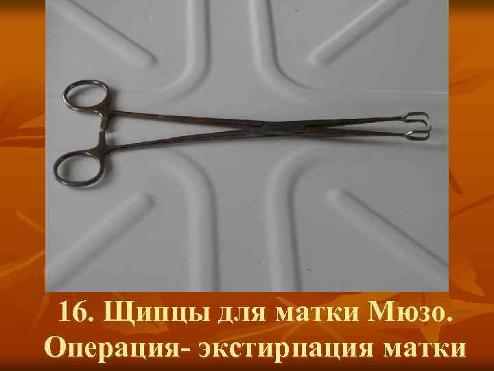 16. Щипцы для матки Мюзо. Операция- экстирпация матки 