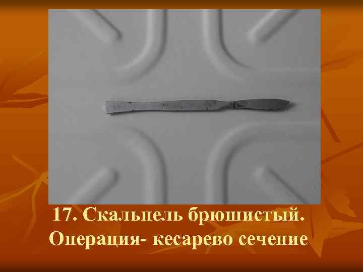17. Скальпель брюшистый. Операция- кесарево сечение 