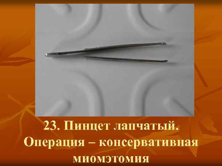 23. Пинцет лапчатый. Операция – консервативная миомэтомия 