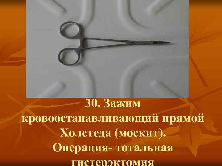 30. Зажим кровоостанавливающий прямой Холстеда (москит). Операция- тотальная гистерэктомия 