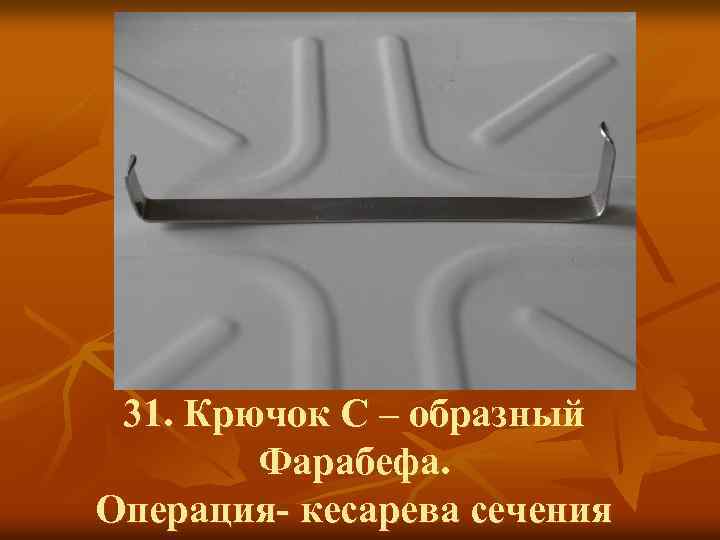 31. Крючок С – образный Фарабефа. Операция- кесарева сечения 
