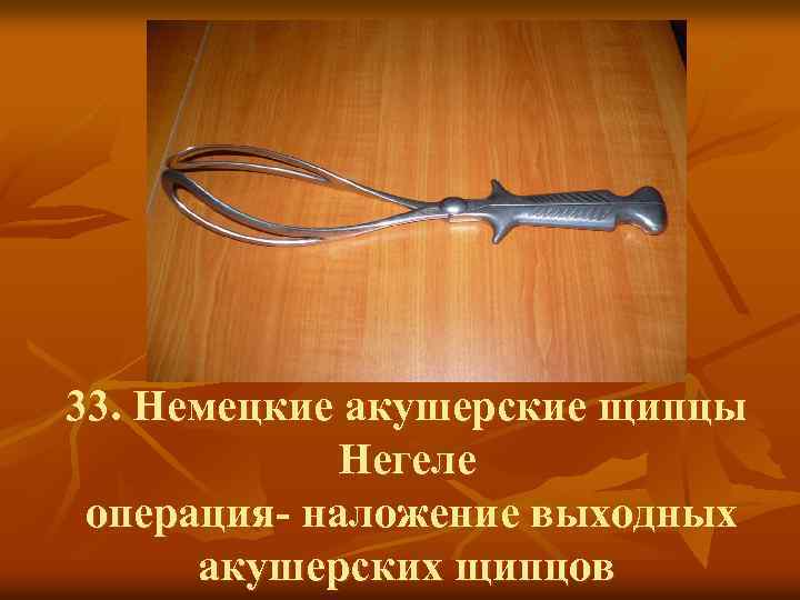 33. Немецкие акушерские щипцы Негеле операция- наложение выходных акушерских щипцов 