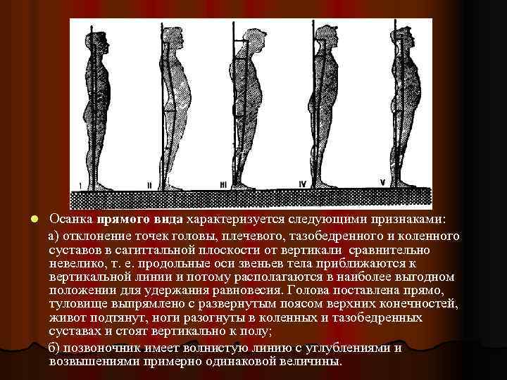 Типы осанки l Осанка прямого вида характеризуется следующими признаками: а) отклонение точек головы, плечевого,