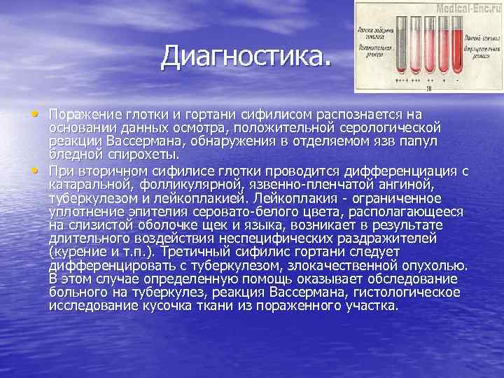 Диагностика. • Поражение глотки и гортани сифилисом распознается на • основании данных осмотра, положительной
