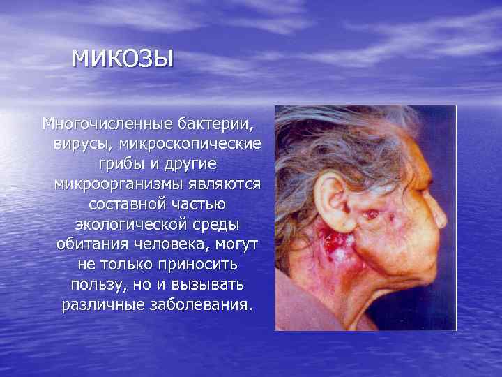 микозы Многочисленные бактерии, вирусы, микроскопические грибы и другие микроорганизмы являются составной частью экологической среды