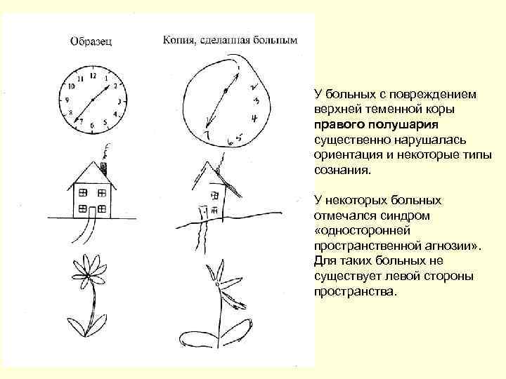 У больных с повреждением верхней теменной коры правого полушария существенно нарушалась ориентация и некоторые