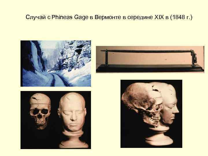 Случай с Phineas Gage в Вермонте в середине XIX в (1848 г. ) 