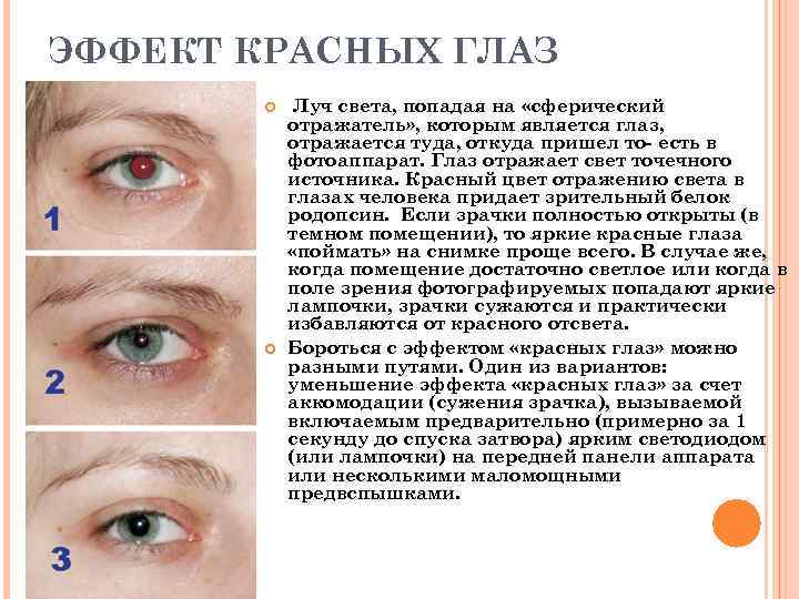 ЭФФЕКТ КРАСНЫХ ГЛАЗ Луч света, попадая на «сферический отражатель» , которым является глаз, отражается