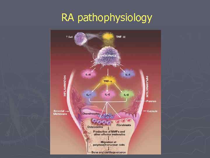 RA pathophysiology 