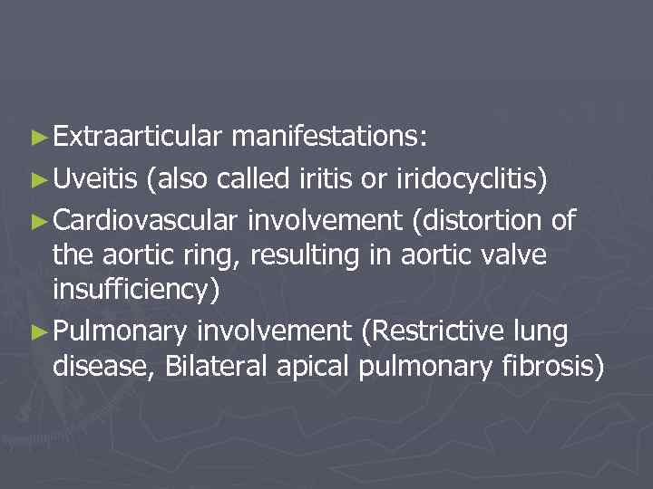 ► Extraarticular manifestations: ► Uveitis (also called iritis or iridocyclitis) ► Cardiovascular involvement (distortion