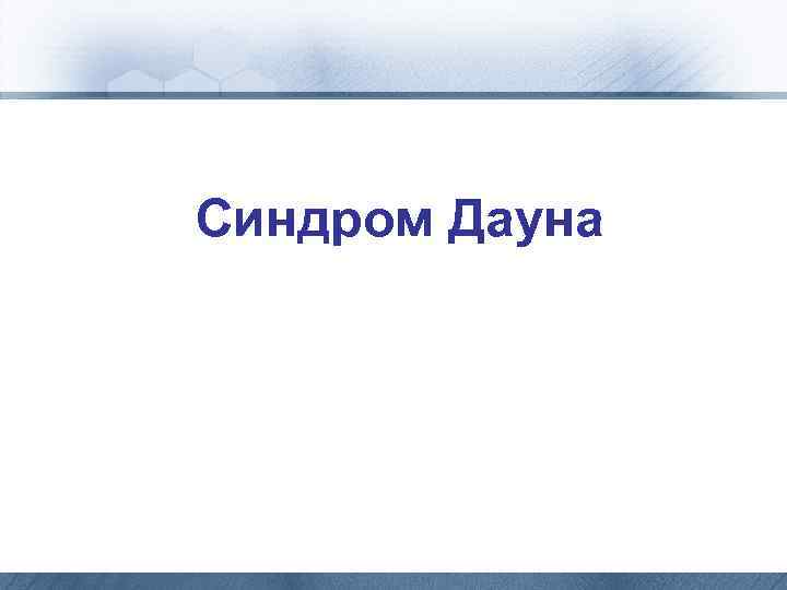 Синдром Дауна 