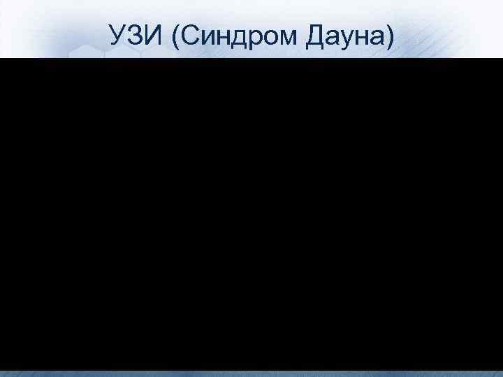 УЗИ (Синдром Дауна) 