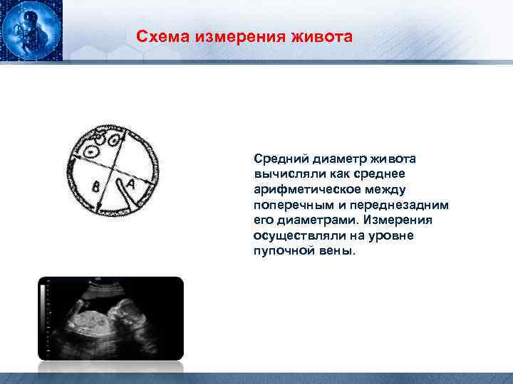 Схема измерения живота Средний диаметр живота вычисляли как среднее арифметическое между поперечным и переднезадним