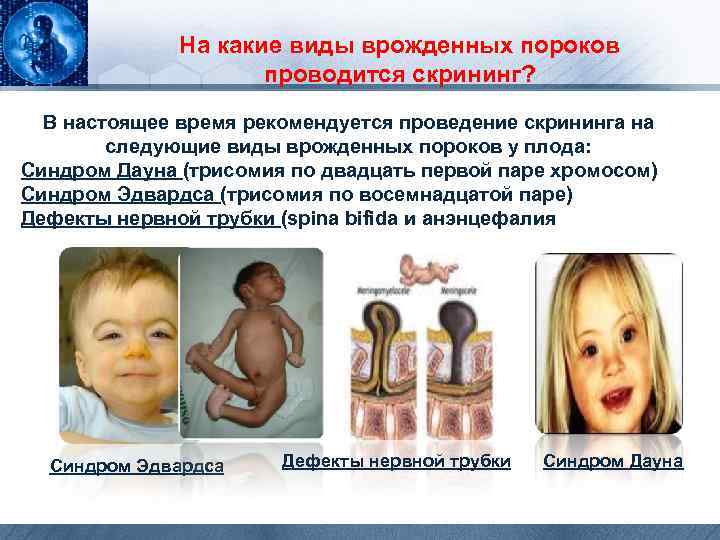 На какие виды врожденных пороков проводится скрининг? В настоящее время рекомендуется проведение скрининга на