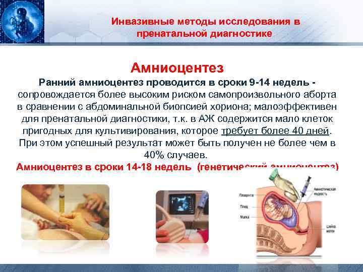 Инвазивные методы исследования в пренатальной диагностике Амниоцентез Ранний амниоцентез проводится в сроки 9 -14