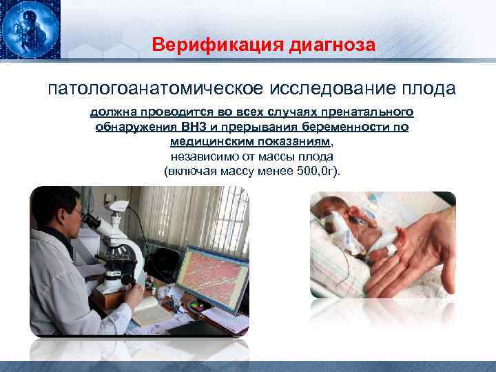 Верификация диагноза патологоанатомическое исследование плода должна проводится во всех случаях пренатального обнаружения ВНЗ и