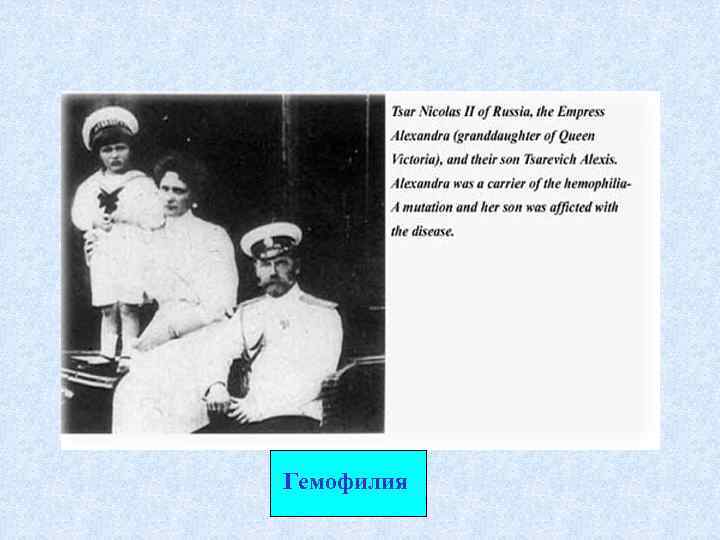 Гемофилия 
