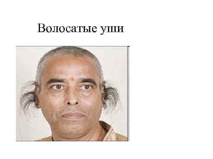 Волосатые уши 