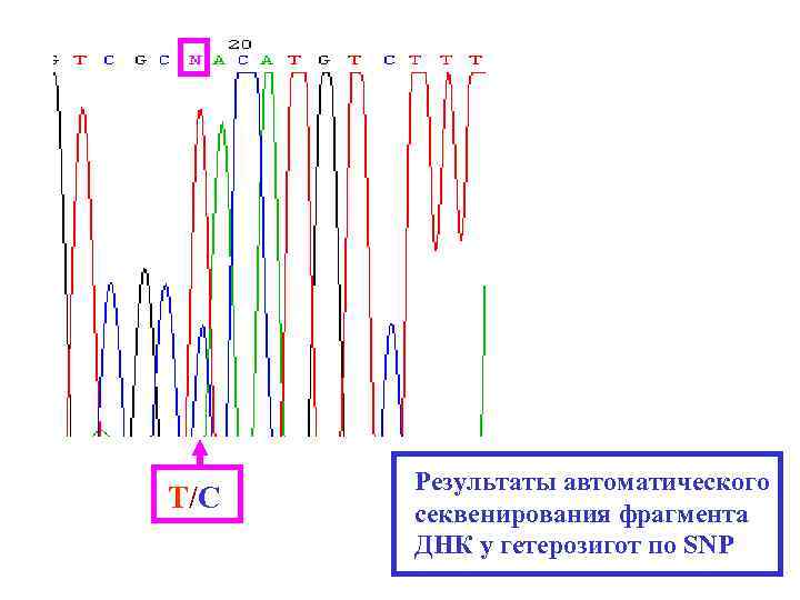 T/C Результаты автоматического секвенирования фрагмента ДНК у гетерозигот по SNP 