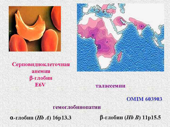 Серповидноклеточная анемия -глобин E 6 V талассемии OMIM 603903 гемоглобинопатии -глобин (Hb A) 16