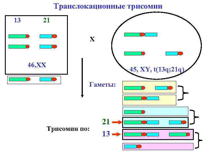 Транслокационные трисомии 13 21 X 46, ХX 45, XY, t(13 q; 21 q) Гаметы: