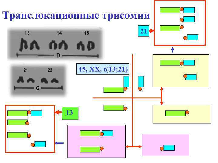 Транслокационные трисомии 21 45, ХХ, t(13; 21) 13 