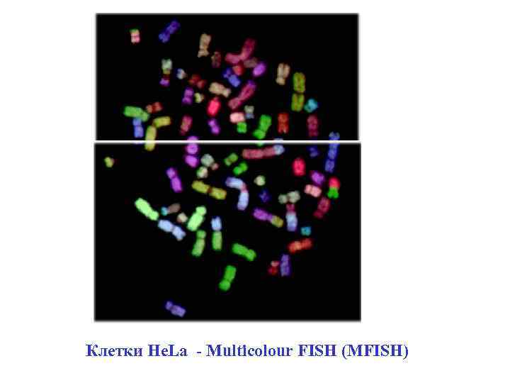 Клетки He. La - Multicolour FISH (MFISH) 