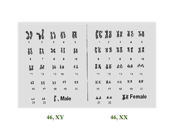 46, XY 46, XX 