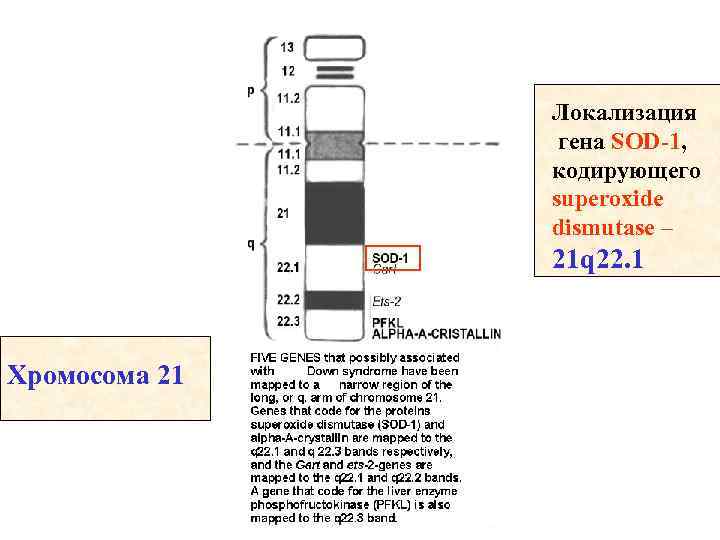 Локализация гена SOD-1, кодирующего superoxide dismutase – 21 q 22. 1 Хромосома 21 
