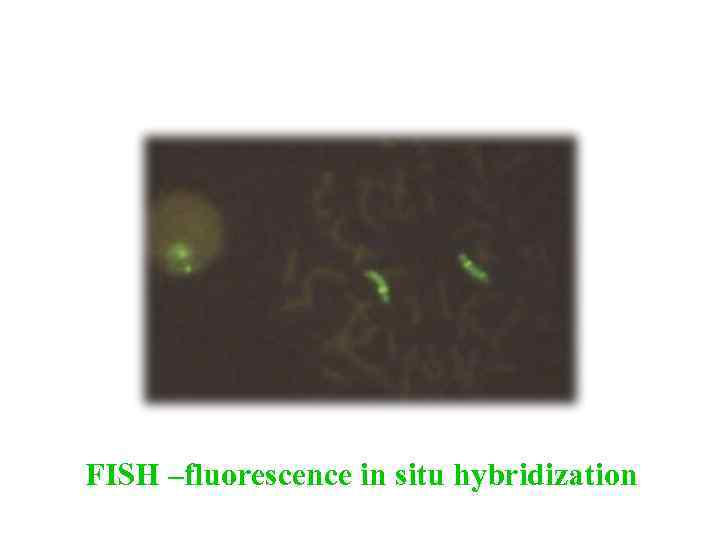 FISH –fluorescence in situ hybridization 