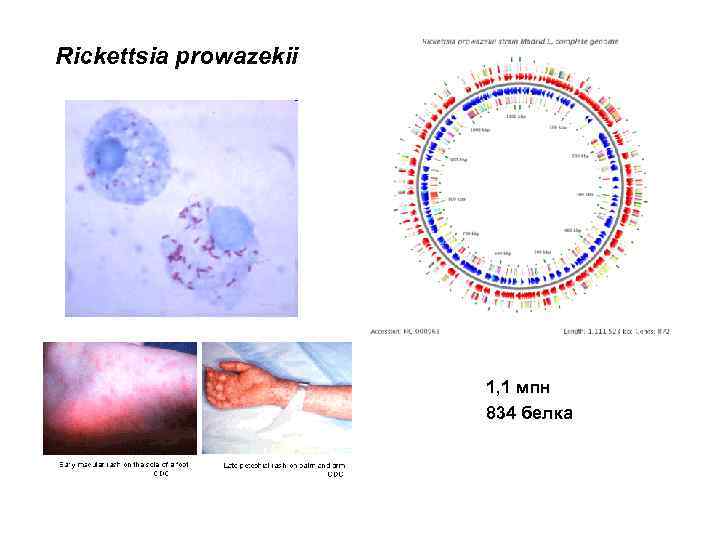 Rickettsia prowazekii 1, 1 мпн 834 белка 