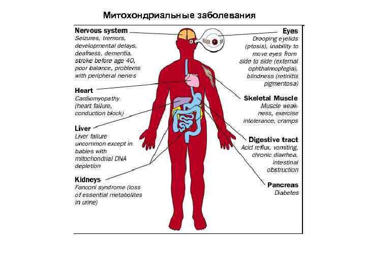 Митохондриальные заболевания 