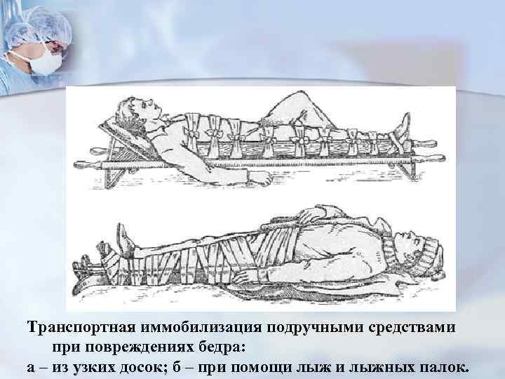 Транспортная иммобилизация фото