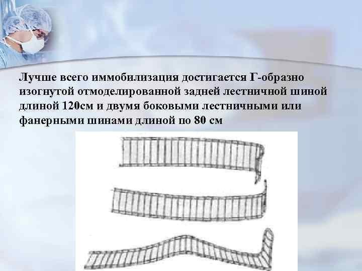 Лучше всего иммобилизация достигается Г-образно изогнутой отмоделированной задней лестничной шиной длиной 120 см и