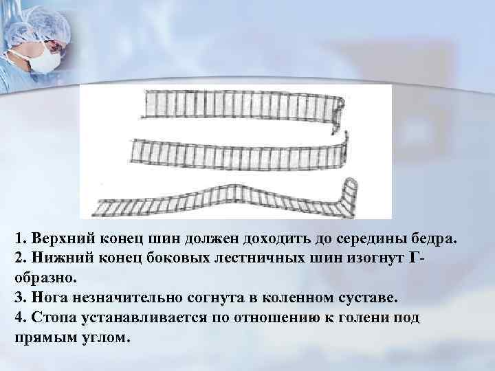 1. Верхний конец шин должен доходить до середины бедра. 2. Нижний конец боковых лестничных