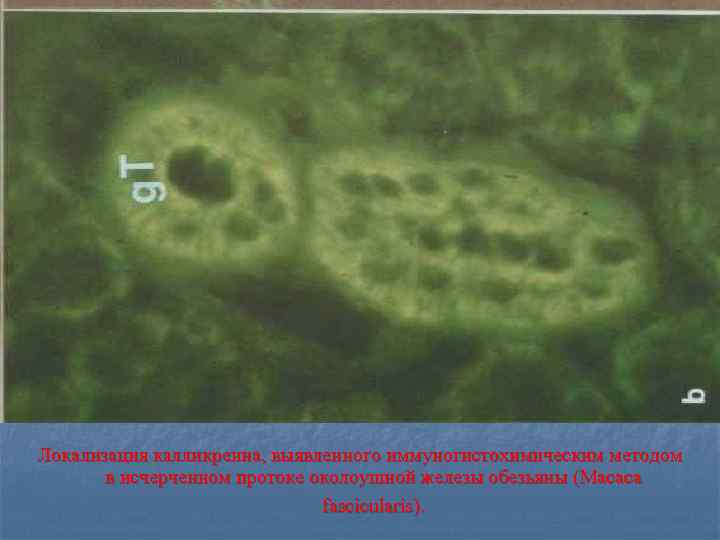 Локализация калликреина, выявленного иммуногистохимическим методом в исчерченном протоке околоушной железы обезьяны (Macaca fascicularis). 