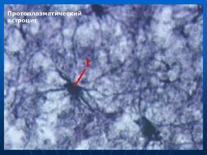 Протоплазматический астроцит 