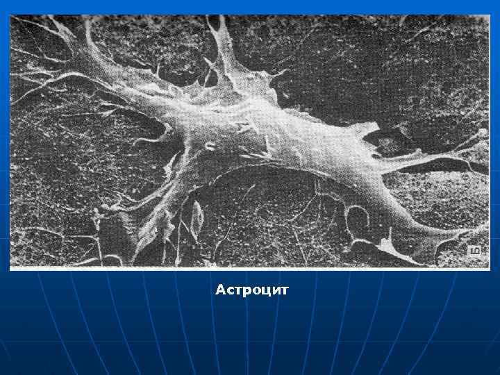 Астроцит 