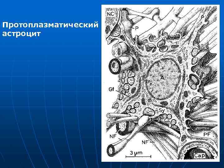 Протоплазматический астроцит 