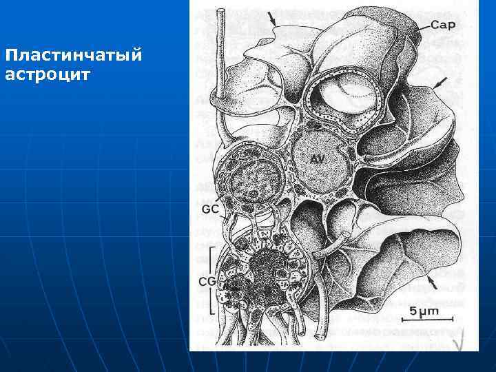 Пластинчатый астроцит 