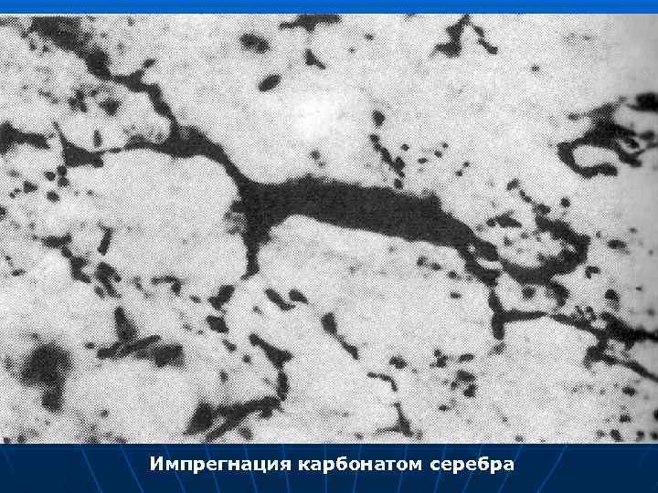 Импрегнация карбонатом серебра 