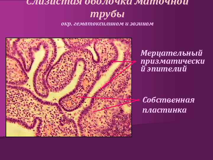 Слизистая оболочка маточной трубы окр. гематоксилином и эозином Мерцательный призматически й эпителий Собственная пластинка